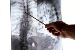 x ray interpretation mistakes x ray interpretation errors